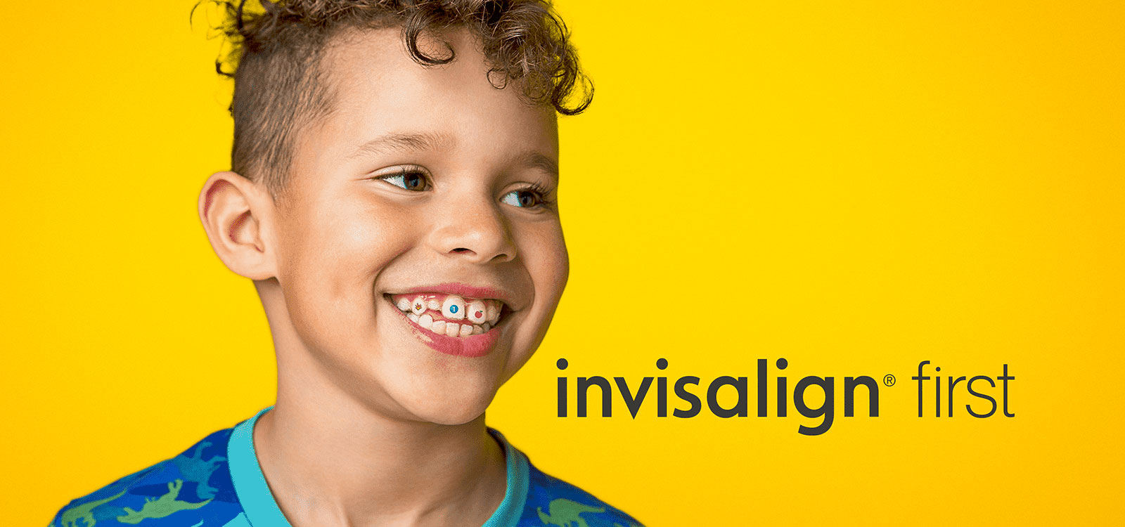 kid smiles showing off his invisalign stickables